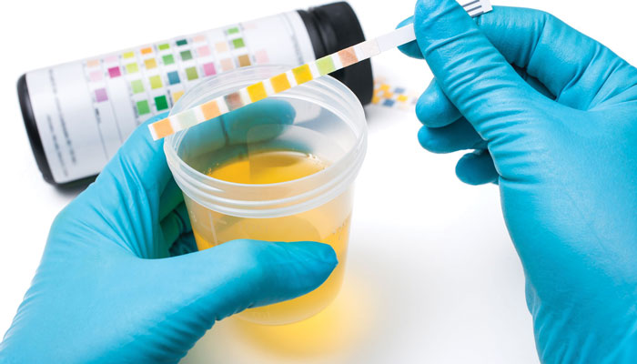 Know-Your-Drug-And-Alcohol-Test-Procedures.jpg