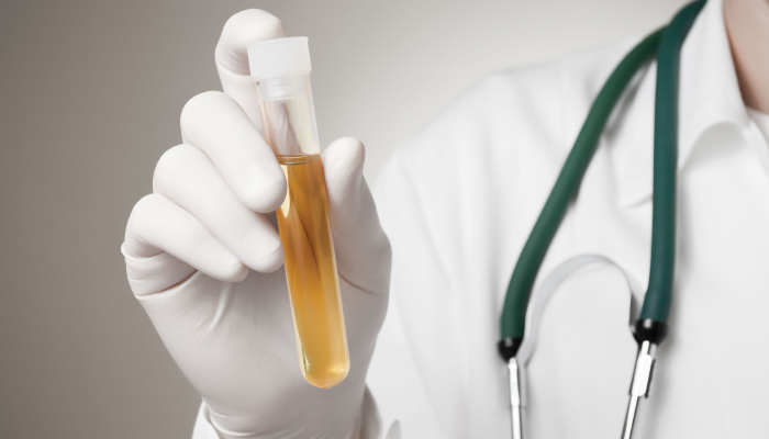 DOT Positive Drug Tests